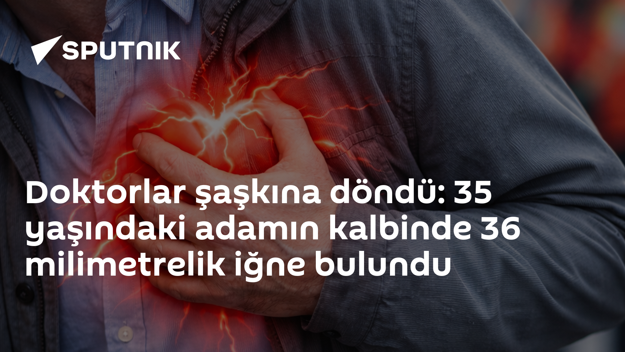 Kalbinde 36 Milimetrelik İğne Bulunan Hastanın Hikayesi Tıp Dünyasını Şoke Etti