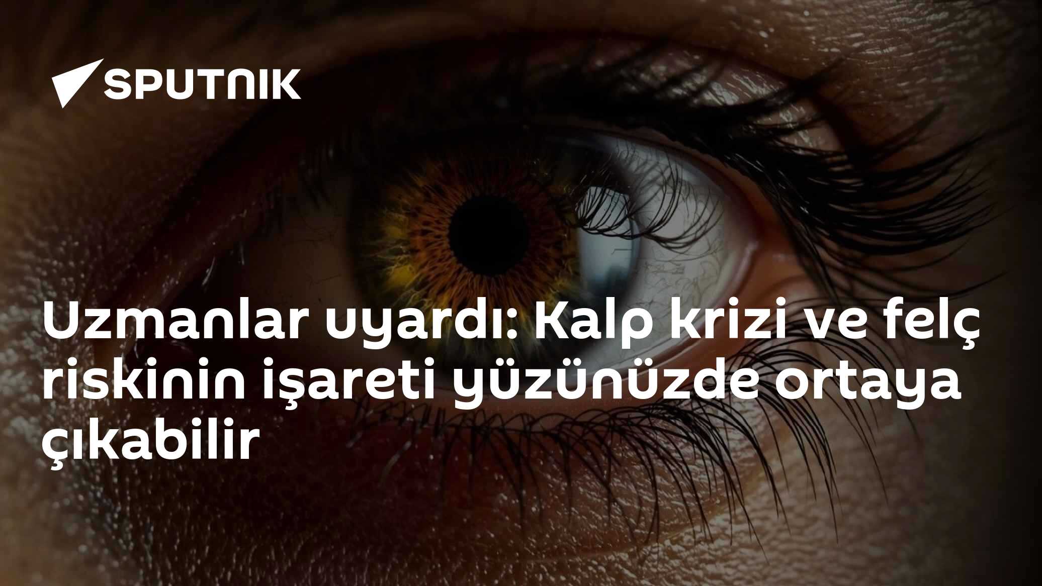 Göz çevresindeki sarı lekeler kalp krizi ve felç riskine işaret edebilir