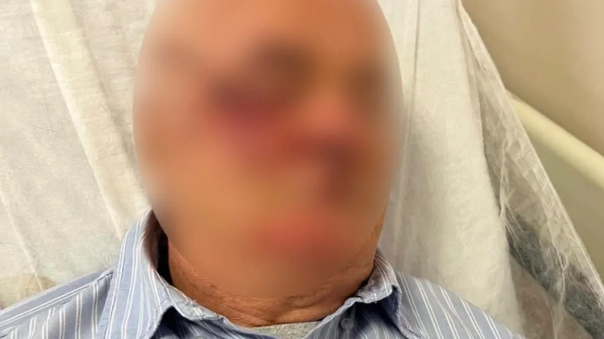 Çocuğunu tehlikeden uyaran emekli başkomisere teşekkür değil darp: Şüpheli 4 suçtan tutuklandı