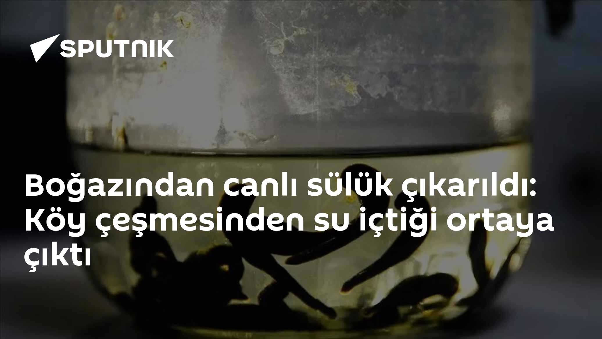 Boğazından Canlı Sülük Çıkarıldı: Köy Çeşmesi Su Uyarısı