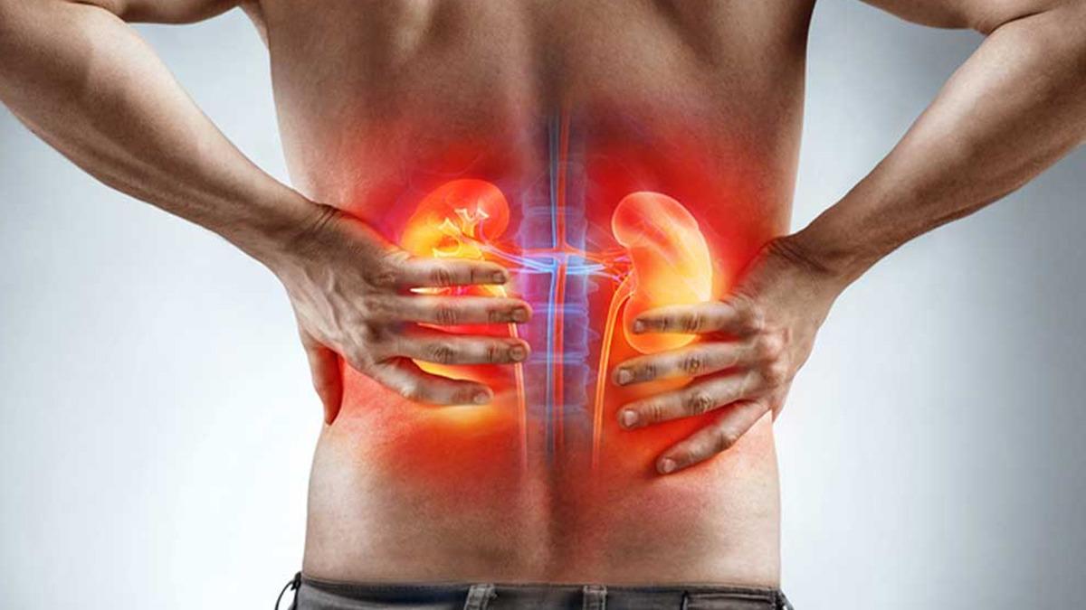 Böbrek Kanseri Sessiz İlerliyor: Uzmandan Sigara, Obezite ve Hipertansiyon Uyarısı