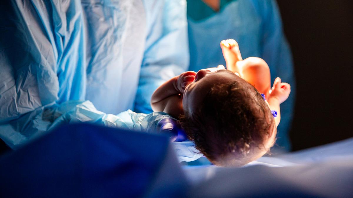 KTÜ'de Son 5 Yılda 20'ye Yakın Bebekte Anne Karnında Tümör Tespit Edildi