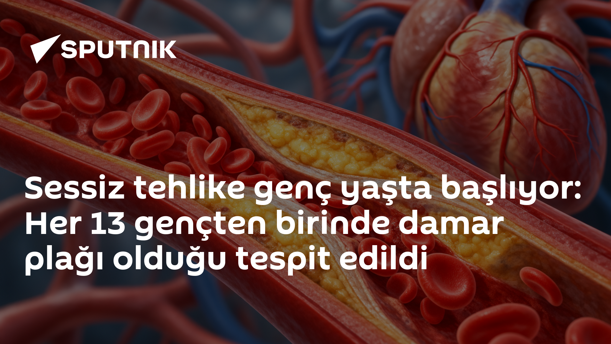 Ateroskleroz 18 Yaşında Başlıyor: Her 13 Gençten Birinde Damar Plağı Tespit Edildi