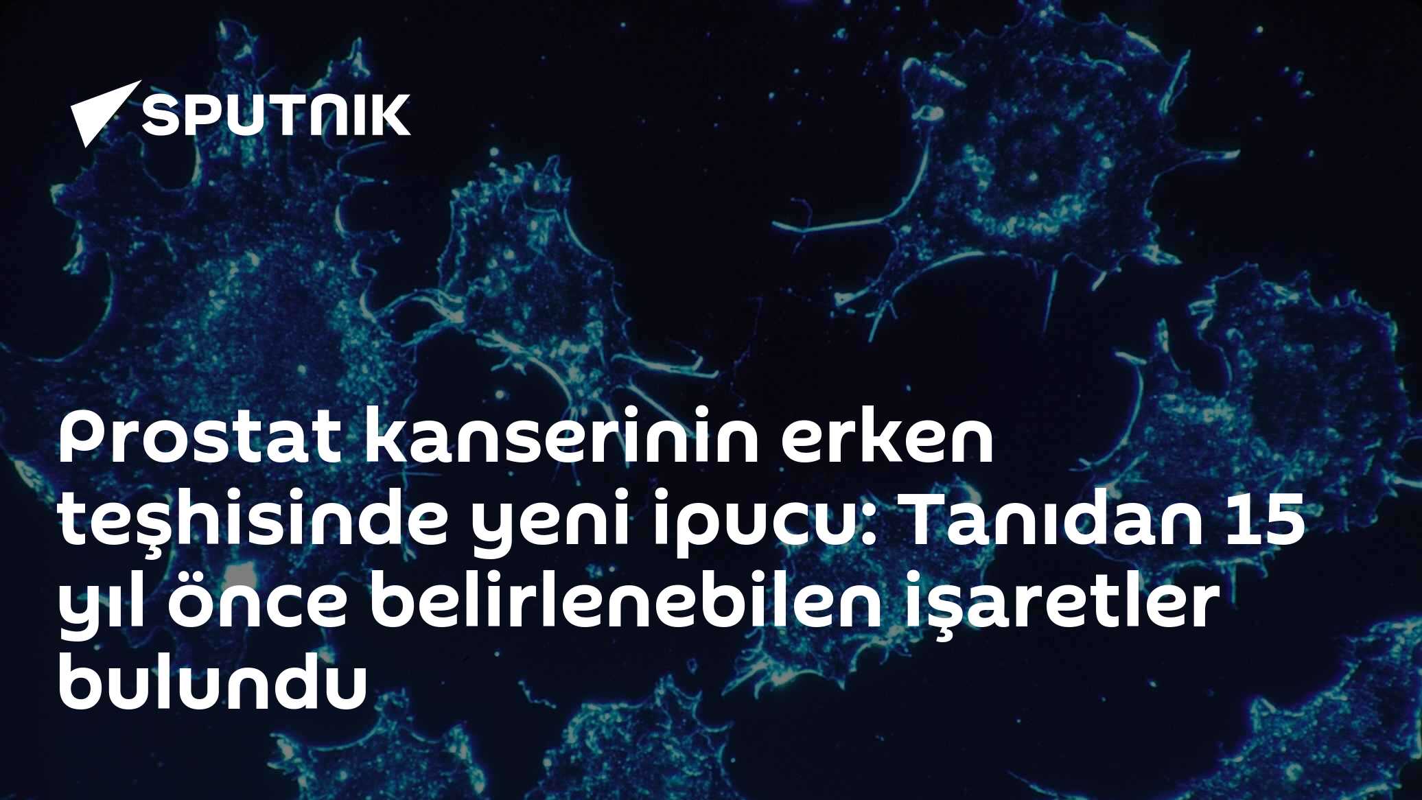 Oxford araştırması: Prostat kanseri tanısından 15 yıl önce kanda iz bırakıyor